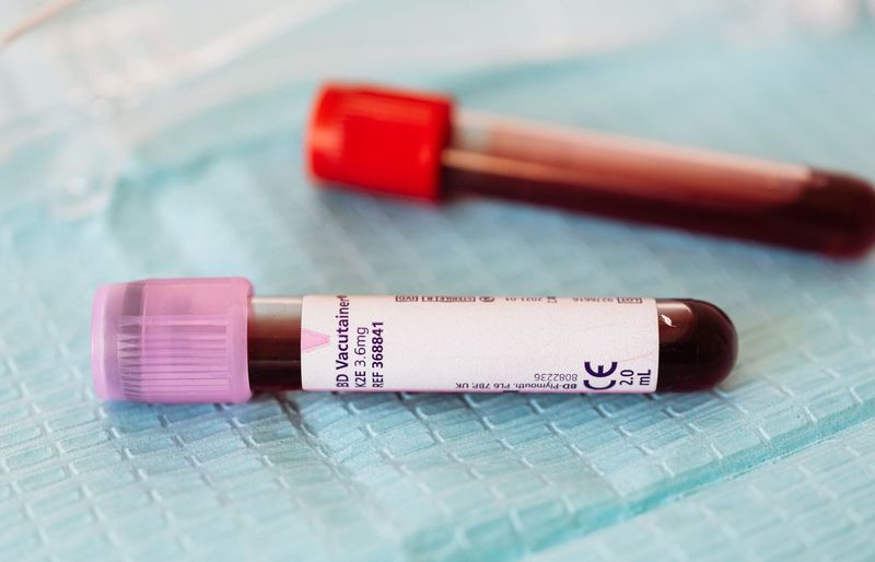 CalRegional Phlebotomy Practice Test course image