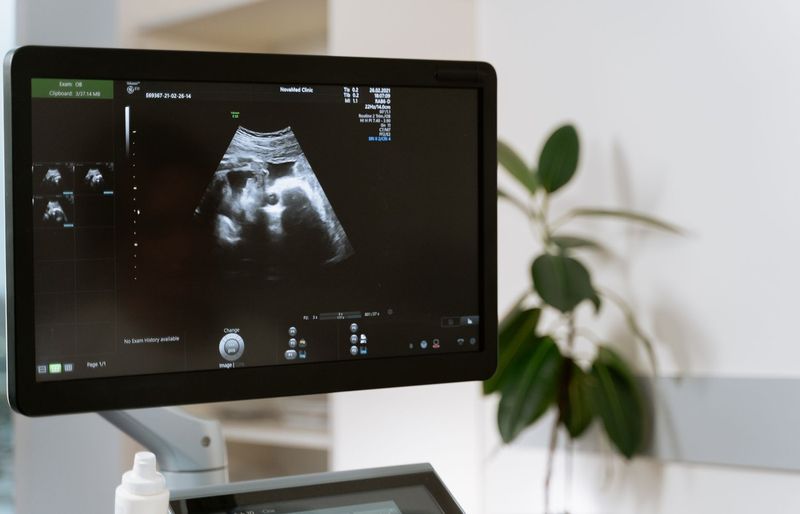 Davies Vascular Technology (VT)