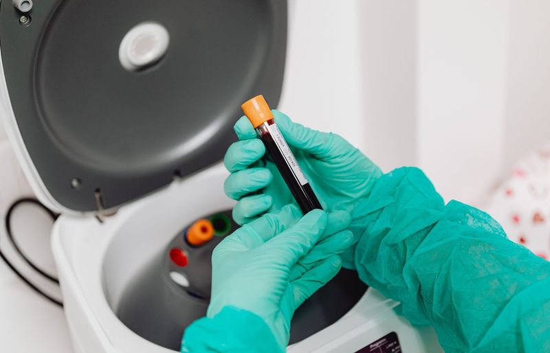 Hemostasis Coagulation Practice Test course image
