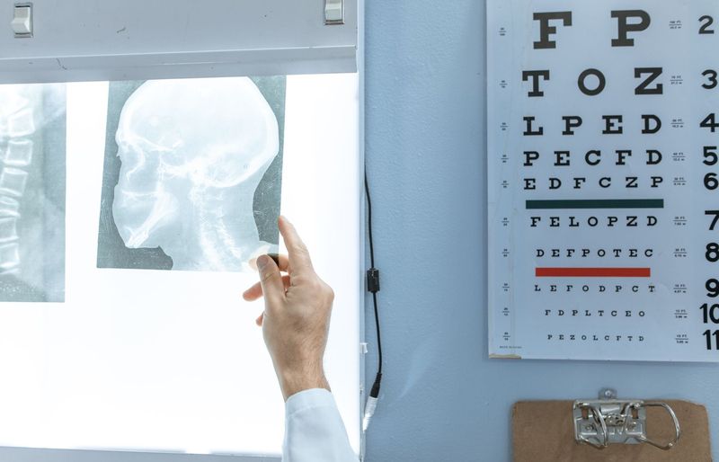 Neurological Screening Practice Test course image