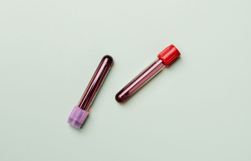 UCP2.04 Bad Blood Practice Test course image