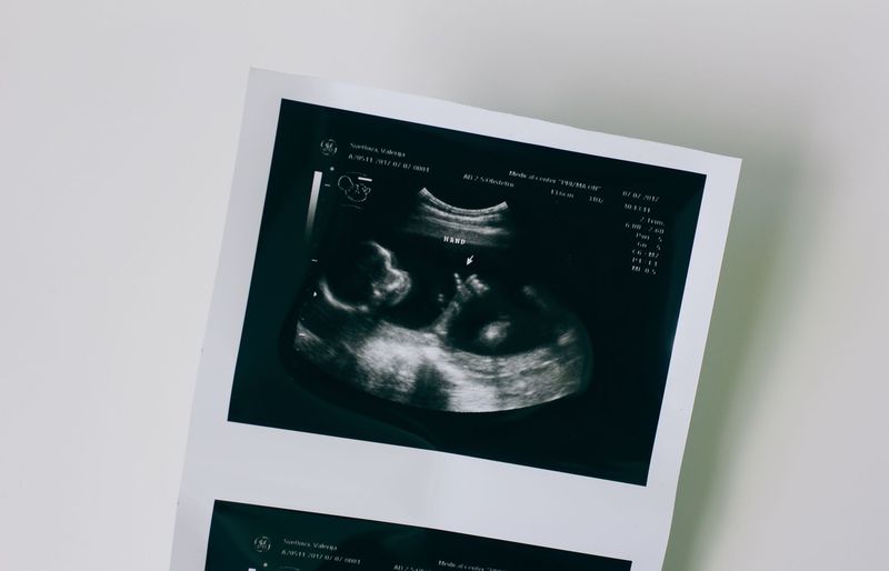 Ultrasound Physics Test 1 Practice