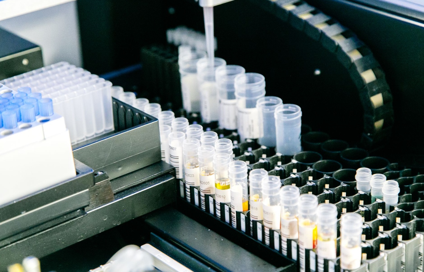 Urinalysis – Physical and Biochemical